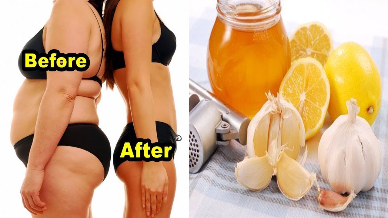 How to Properly Use Garlic and Lemon for Weight Loss Fast – No Strict Diet No Workout